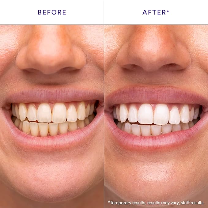 Purple Teeth Whitening Strips – Gentle Daily Purple Whitening Strips for Surface Stain Reduction & Natural Shine, Portable Whitening Strips Purple for Home or On-The-Go Use (14)