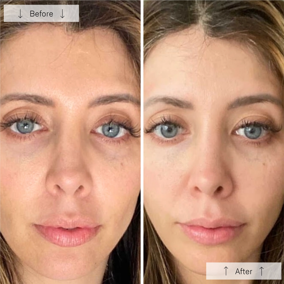 Omnilux Contour LED Face Mask